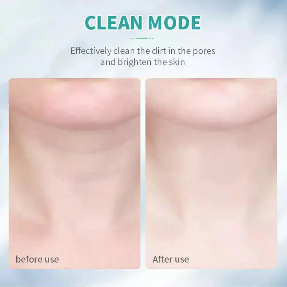 Neck Face Massager Skin Care Facial Massage Device with 3 Color Modes for Skin Rejuvenation Face Sculpting Tool for Double Chin